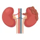 Kidney Cancer Surgery